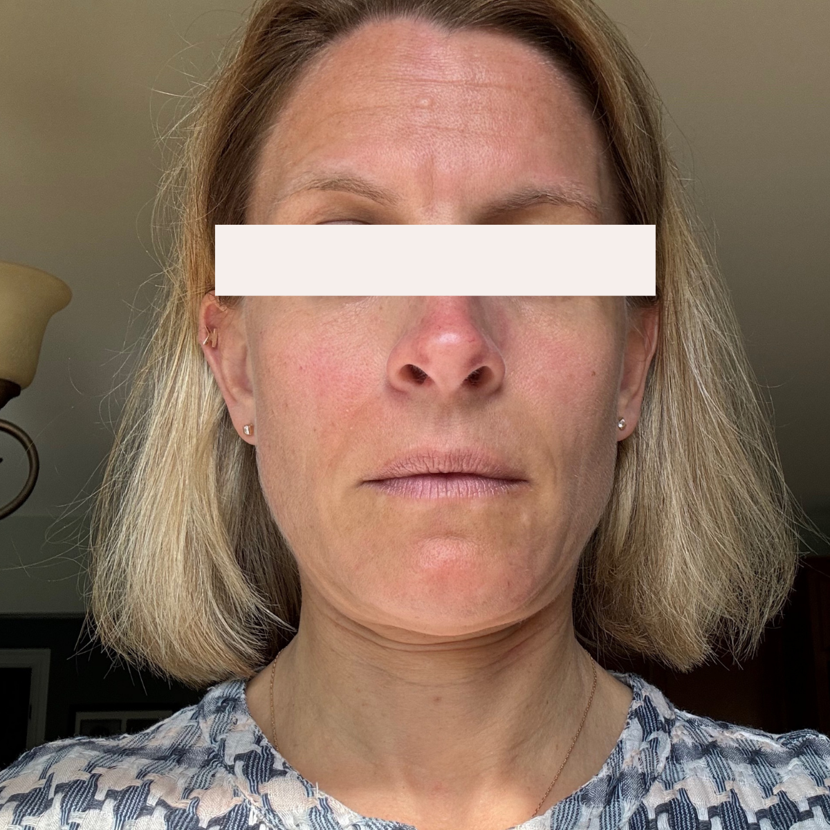 KSW Client after a historically published KSW skin journey