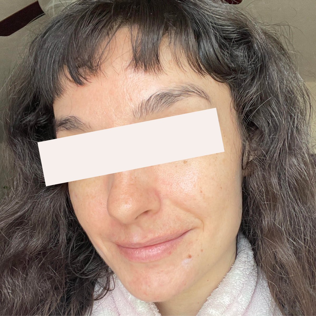 Tay after a historically published KSW skin journey
