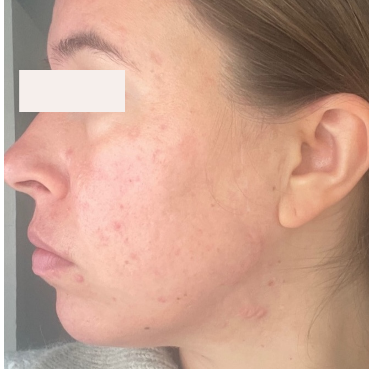 Faith after a historically published KSW skin journey