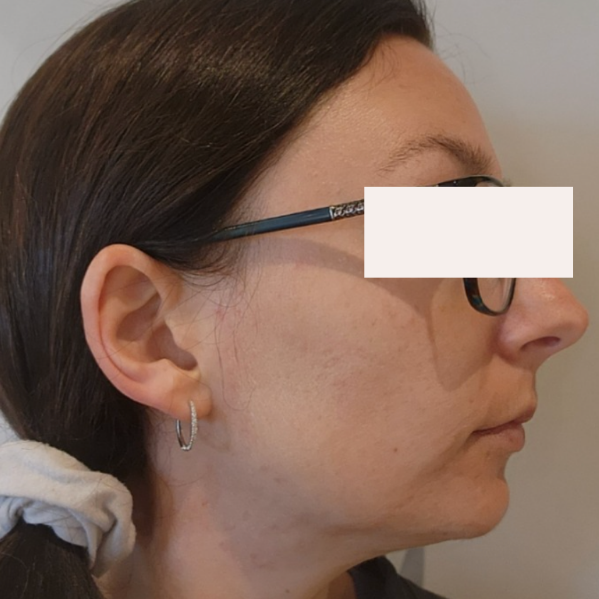 KSW Client after a historically published KSW skin journey