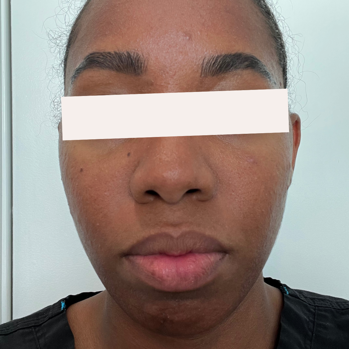 Jade after a historically published KSW skin journey