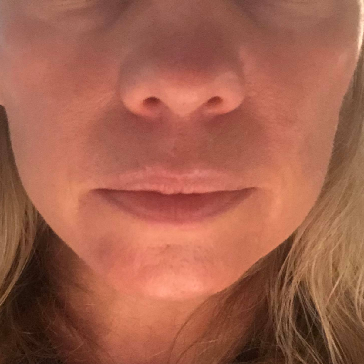 KSW Client after a historically published KSW skin journey