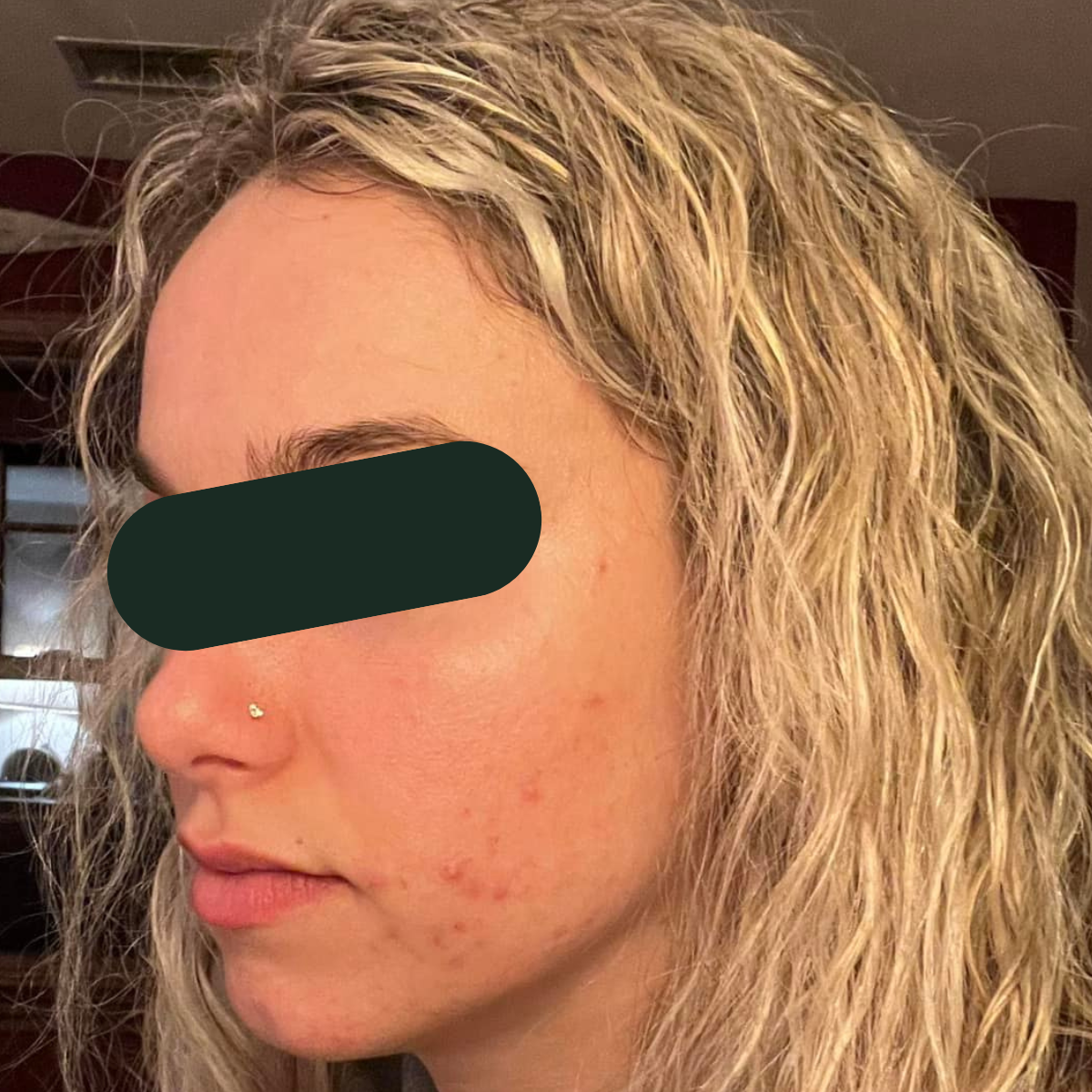 Before photo of Amanda, a KSW client