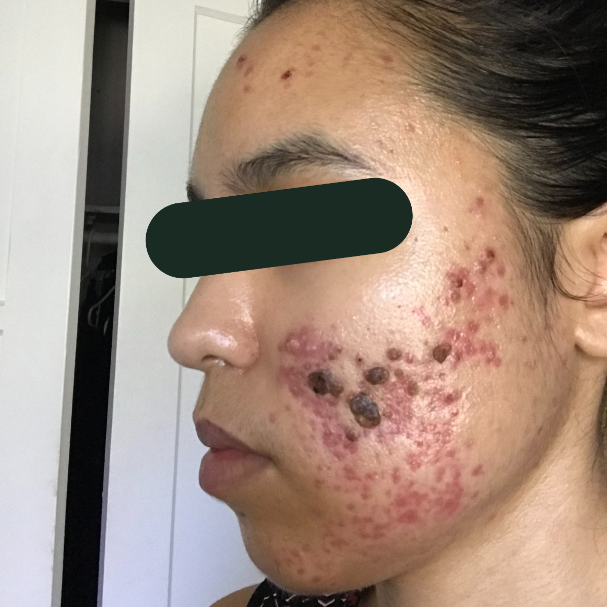 Before photo of Faith, a KSW client