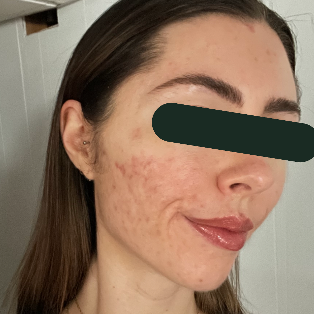 After photo of Lizzie, a KSW client