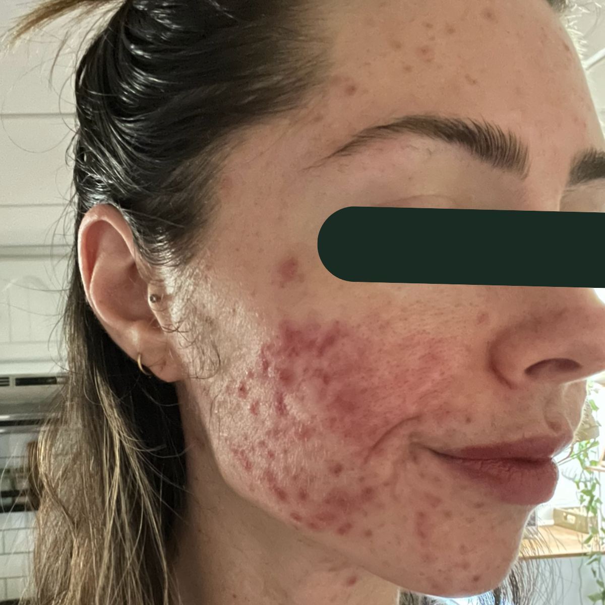 Before photo of Lizzie, a KSW client